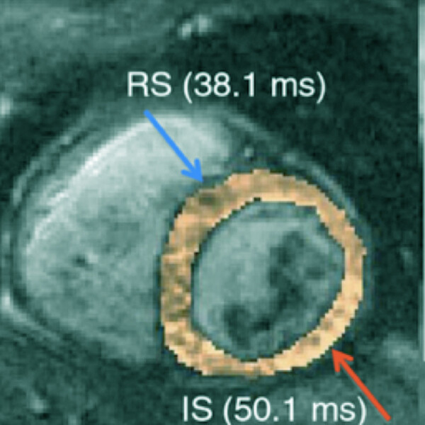 An image of Biomedical Imaging